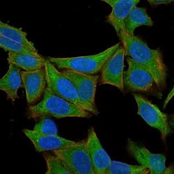 Fascin Antibody (SPM133), Novus Biologicals 0.02mg; Unlabeled:Antibodies,