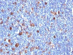 Fascin Antibody (SPM133), Novus Biologicals 0.02mg; Unlabeled:Antibodies,