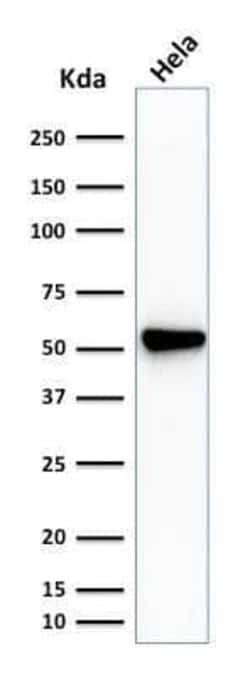 Fascin Antibody (SPM133), Novus Biologicals 0.02mg; Unlabeled:Antibodies,
