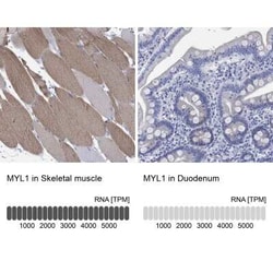 Fast skeletal myosin light chain 1 Rabbit anti-Human, Polyclonal, Novus