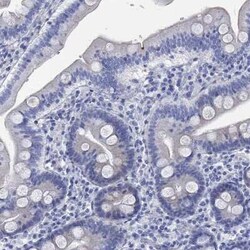 Fast skeletal myosin light chain 1 Rabbit anti-Human, Polyclonal, Novus