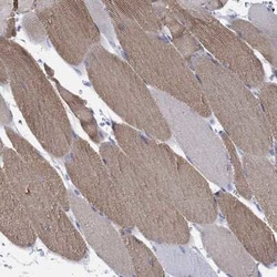 Fast skeletal myosin light chain 1 Rabbit anti-Human, Polyclonal, Novus