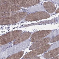 Fast skeletal myosin light chain 2 Antibody, Novus Biologicals:Antibodies:Primary