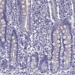Fast skeletal myosin light chain 2 Antibody, Novus Biologicals:Antibodies:Primary