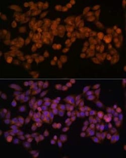 Fatty Acid Synthase/FASN Rabbit anti-Human, Mouse, Clone: 4U9S3, Novus Biologicals 20 &mu;g | Buy Online | Bio-Techne | Fisher Scientific