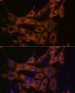 Fatty Acid Synthase/FASN Rabbit anti-Human, Mouse, Clone: 4U9S3, Novus Biologicals 20 &mu;g | Buy Online | Bio-Techne | Fisher Scientific
