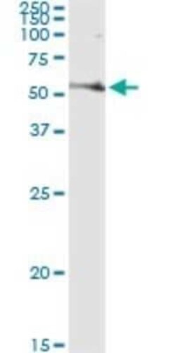 Fatty Acid Synthase/FASN Antibody (3F2-1F3), Novus Biologicals 0.05 mg | Buy Online | Novus Biologicals | Fisher Scientific