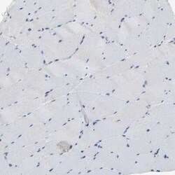 Fc gamma RIIA/CD32a Antibody, Novus Biologicals 0.1 mL; Unconjugated:Antibodies,