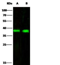 Fc gamma RIIB/CD32b Rabbit anti-Human, Clone: 110, Novus Biologicals 100