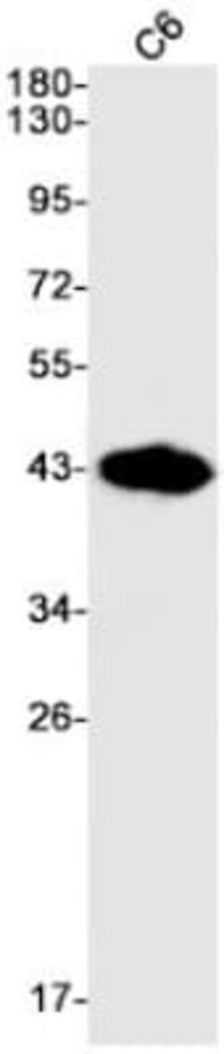 Fc gamma RIIB/CD32b Antibody (S07-4B5), Novus Biologicals:Antibodies:Primary