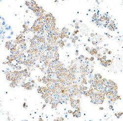 Fc gamma RIIIA/CD16a Antibody (BLR162J), Novus Biologicals 100 &mu;g | Buy Online | Novus Biologicals | Fisher Scientific