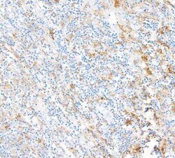 Fc gamma RIIIA/CD16a Antibody (BLR162J), Novus Biologicals 100 &mu;g | Buy Online | Novus Biologicals | Fisher Scientific