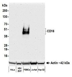 Fc gamma RIIIB/CD16b Antibody (BLR163J), Novus Biologicals 100 &mu;g | Buy Online | Novus Biologicals | Fisher Scientific