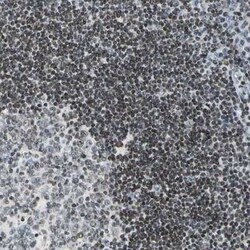 Fer Antibody, Novus Biologicals 25 &mu;L | Buy Online | Novus Biologicals | Fisher Scientific