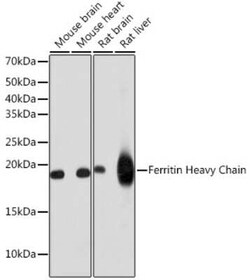 Ferritin Heavy Chain Rabbit anti-Human, Mouse, Rat, Clone: 1Q10I7, Novus Biologicals 100 &mu;g | Buy Online | Bio-Techne | Fisher Scientific