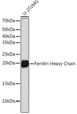 Ferritin Heavy Chain Rabbit anti-Human, Mouse, Rat, Clone: 1Q10I7, Novus Biologicals 100 &mu;g | Buy Online | Bio-Techne | Fisher Scientific