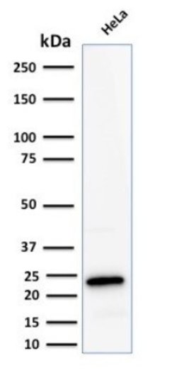 Ferritin Light Chain Antibody (FTL/2338R) - Azide and BSA Free, Novus Biologicals 100 &mu;g | Buy Online | Novus Biologicals | Fisher Scientific