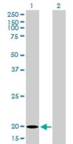 Ferritin Light Chain Antibody (X1), Novus Biologicals 0.1 mg | Buy Online | Novus Biologicals | Fisher Scientific