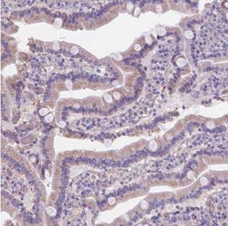 Ferroportin/SLC40A1 Antibody, Novus Biologicals:Antibodies:Primary Antibodies