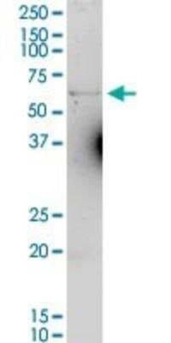 Ferroportin/SLC40A1 Antibody, Novus Biologicals 0.1 mg, Unconjugated:Antibodies,