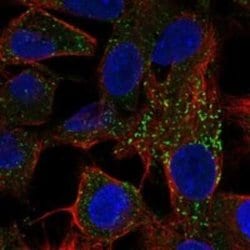 Fetuin Rabbit anti-Human, Polyclonal, Novus Biologicals 100 &mu;g; Unconjugated:Antibodies,