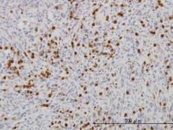 Fgr Antibody (1B12), Novus Biologicals 0.1 mg | Buy Online | Novus Biologicals | Fisher Scientific