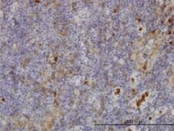 Fgr Antibody (3B11), Novus Biologicals 0.1 mg | Buy Online | Novus Biologicals | Fisher Scientific