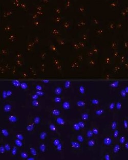 Fibrillarin Rabbit anti-Human, Mouse, Rat, Clone: 9J5O2, Novus Biologicals:Antibodies:Primary