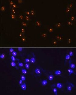 Fibrillarin Rabbit anti-Human, Mouse, Rat, Clone: 9J5O2, Novus Biologicals:Antibodies:Primary