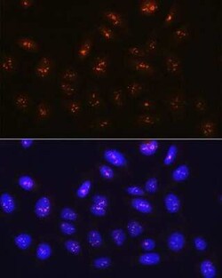 Fibrillarin Rabbit anti-Human, Mouse, Rat, Clone: 9J5O2, Novus Biologicals:Antibodies:Primary