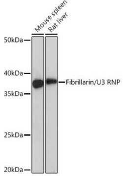 Fibrillarin Rabbit anti-Human, Mouse, Rat, Clone: 9J5O2, Novus Biologicals:Antibodies:Primary