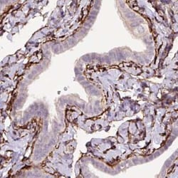 Fibrillin 1 Antibody (CL0225), Novus Biologicals 25 &mu;L, Unconjugated:Antikörper