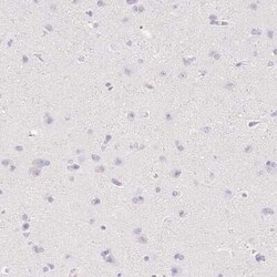 Fibrillin 1 Antibody, Novus Biologicals 25 &mu;L | Buy Online | Novus Biologicals | Fisher Scientific