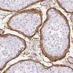 Fibrillin 1 Antibody, Novus Biologicals 25 &mu;L | Buy Online | Novus Biologicals | Fisher Scientific