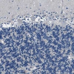 Fibrillin 1 Antibody, Novus Biologicals:Antibodies:Primary Antibodies