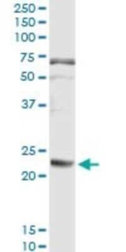 Fibrinopeptide A Antibody (1D12), Novus Biologicals 0.1 mg | Buy Online | Novus Biologicals | Fisher Scientific