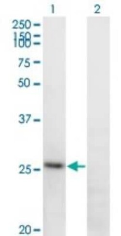 Fibrinopeptide A Antibody (1D12), Novus Biologicals 0.1 mg | Buy Online | Novus Biologicals | Fisher Scientific