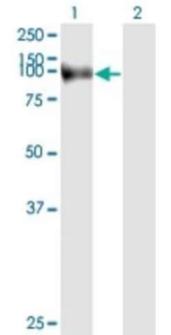 Fibroblast Activation Protein alpha/FAP Antibody (1E5), Novus Biologicals