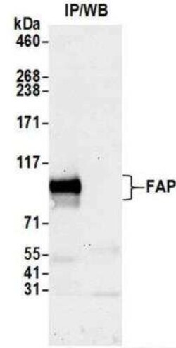 Fibroblast Activation Protein alpha/FAP Antibody (BLR150J), Novus Biologicals 100 &mu;g | Buy Online | Novus Biologicals | Fisher Scientific