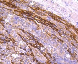 Fibroblast Activation Protein alpha/FAP Antibody (JA56-11), Novus Biologicals