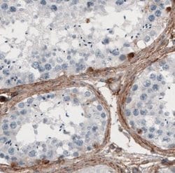 Fibronectin Antibody (CL3730), Novus Biologicals:Antibodies:Primary Antibodies