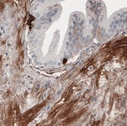 Fibronectin Antibody (CL3730), Novus Biologicals:Antibodies:Primary Antibodies