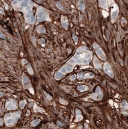 Fibronectin Antibody (CL3730), Novus Biologicals:Antibodies:Primary Antibodies