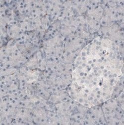 Fibronectin Antibody (CL3730), Novus Biologicals:Antibodies:Primary Antibodies