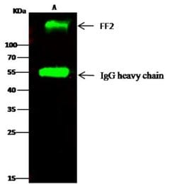 Fibronectin Rabbit anti-Human, Clone: 14, Novus Biologicals 100 &mu;g;