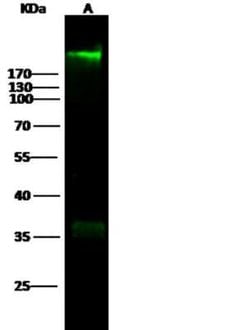 Fibronectin Rabbit anti-Human, Clone: 14, Novus Biologicals 100 &mu;g;