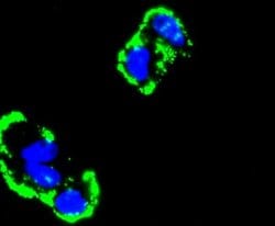 Fibronectin Antibody (JF0582), Novus Biologicals 100&mu;L:Antibodies, Monoclonal