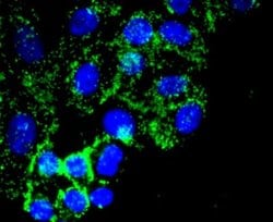 Fibronectin Antibody (JF0582), Novus Biologicals 100&mu;L:Antibodies, Monoclonal