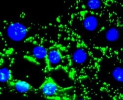 Fibronectin Antibody (JF0582), Novus Biologicals 100&mu;L:Antibodies, Monoclonal