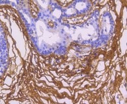 Fibronectin Antibody (JF0582), Novus Biologicals 100&mu;L:Antibodies, Monoclonal
